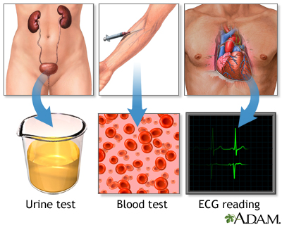 High blood pressure tests