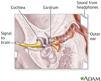 Sound wave transmission