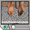 Ankle ligament injury