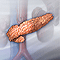 Diabetes