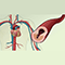 Cardiovascular disease - description