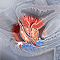 Enlarged prostate