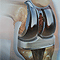 Knee joint replacement