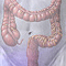 Colon cancer screening