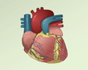 Coronary artery disease (CAD) overview