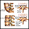 Back pain - age factors